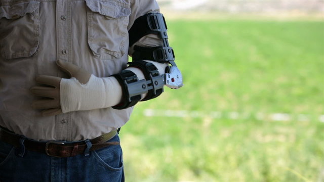 Medical man in arm brace after surgery HD 8224