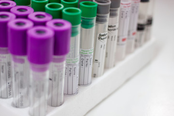 test tubes for testing