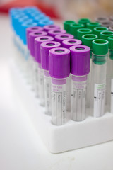 test tubes for testing