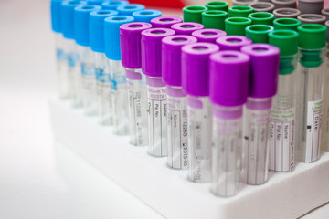 test tubes for testing