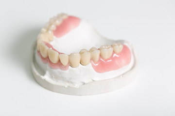 Prothesensattel mit Zahnersatz im Zahntechnischen Labor
