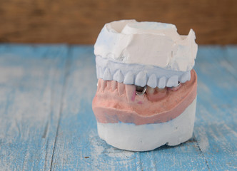 Denture mold,false teeth on wooden floor.