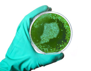 Germs in the shape of Uganda in a petri dish.(series)