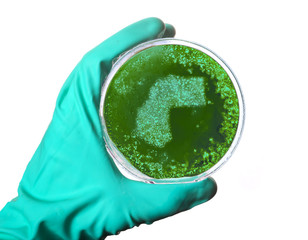 Germs in the shape of Western Sahara in a petri dish.(series)
