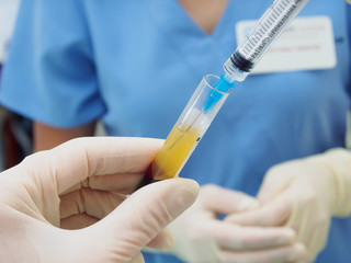 Hands holding separated blood and syringe in test tube at  laboratory