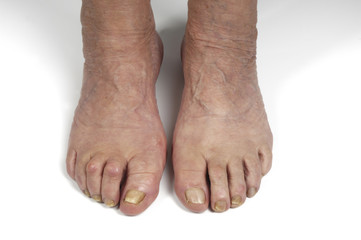 senior woman foot