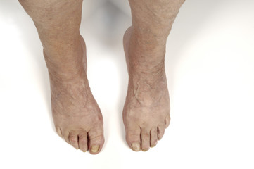 Senior woman foot