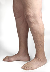 senior woman leg