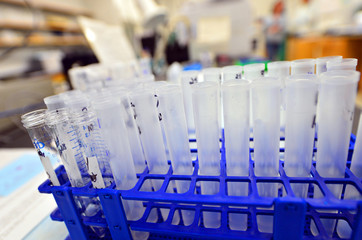 Lab equipment in a lab.