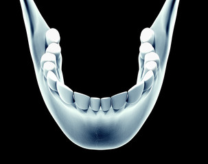 x-ray image of a jaw with teeth