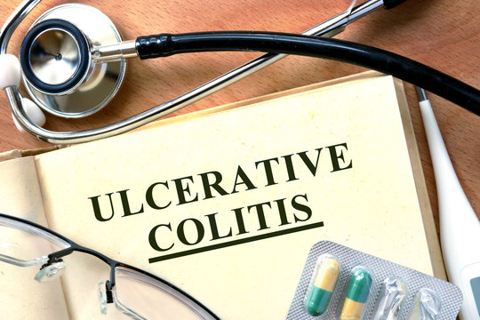 Ulcerative Colitis  Concept. Book With Stethoscope And Pills.