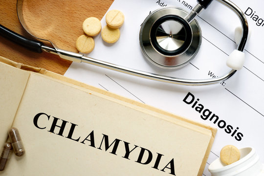 Word  Chlamydia on a paper and pills on the wooden table.