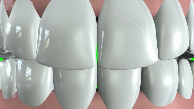 A set of human false teeth set in gums opening and closing on a green screen background