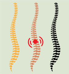 Spine vector