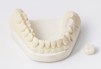 ceramic crowns in dental laboratory