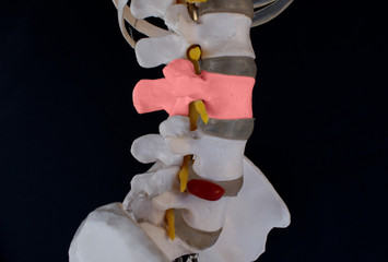 Lumbar Vertebrae- L3