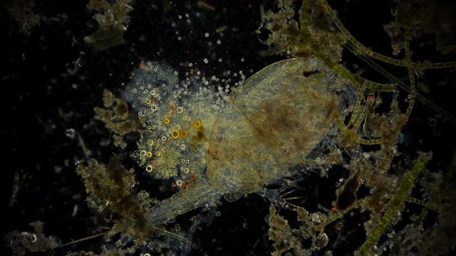 Mikroorganismus im Mikroskop - 1080p Full HD