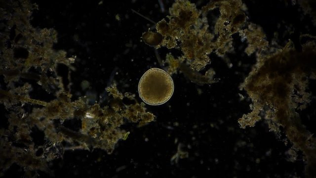 Mikroorganismus im Mikroskop - 1080p Full HD