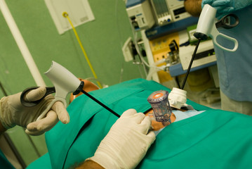 Cirujano en prácticas realiando una endoscopia