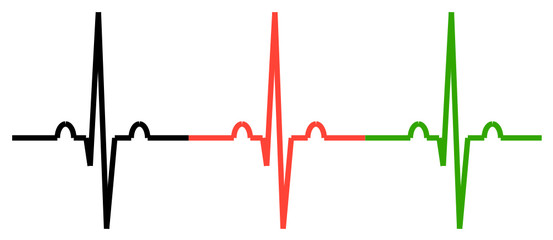 1075 - ECG waves
