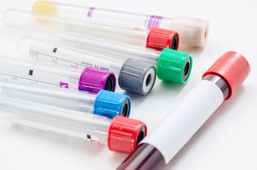 vacuum tubes for collecting and blood samples.