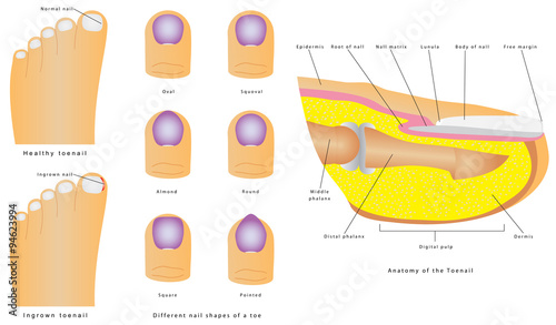 "Anatomy of the Toenail" Stock image and royalty-free vector files on