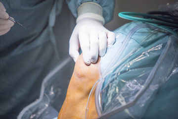 Obraz na płótnie Canvas Traumatology orthopedic surgery knee arthroscopy drip