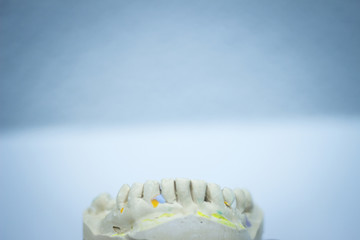 Dental mold dentist clay teeth ceramic plate model cast