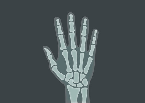 Handknochen