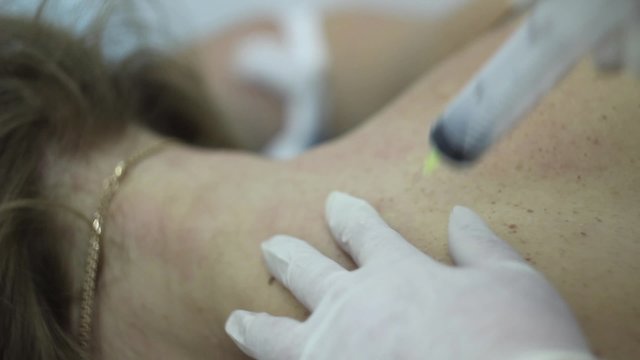 Ozone therapy. A doctor with a syringe 