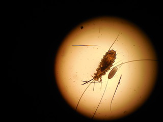 louse and egg Polyplax spinulosa, under the microscope, found in the rat at a reception at a veterinary dermatologist