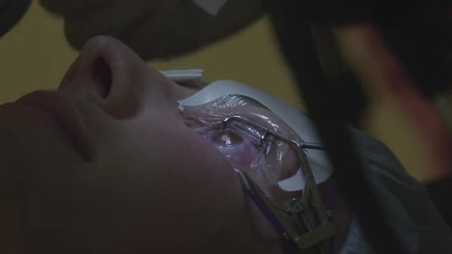 STEP 9 CLOSE UP: Vision correction with laser