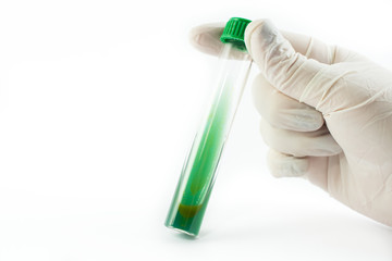 Hand in glove holding laboratory test tubes infected with different bacteria isolated on white background