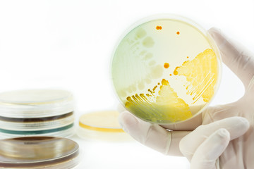 Hand in glove holding petri dish with bacteria growing on it isolated on white background. Medical tests and research. Bacterial cultures in laboratory glassware