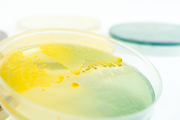 Bacteria colonies on petri dish. Concept for laboratory medicine