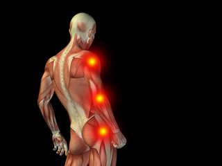 Conceptual human body anatomy pain on black