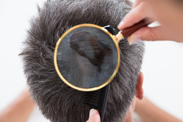 Dermatologist Checking Patient's Hair In Magnifying Glass