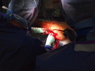chirurgen operieren