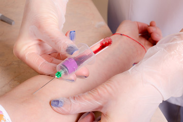 Blood collection for research of hand