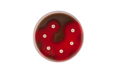 Antibiogram showing sensibility to Streptococcus pneumoniae bacteria on petri dish