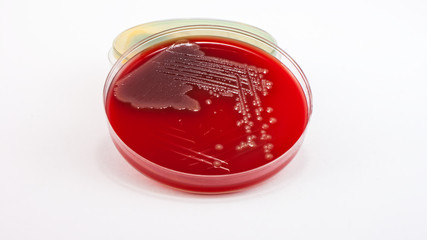 Escherichia Coli bacteria on columbia blood agar