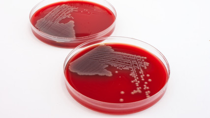 Escherichia Coli bacteria on columbia blood agar