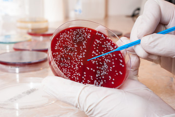 Laboratory doctor hands with sterile gloves holding inoculation loop on blood agar infected with...