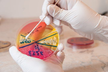 Sterile swab and Staphylococcus aureus bacteria on petri dish. Laboratory doctor holding petri...