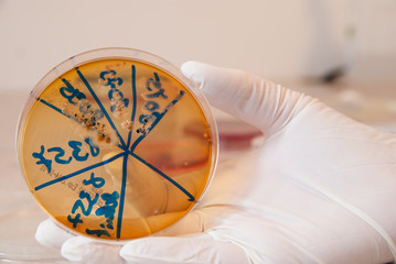 Stool sample on petri dish. Laboratory doctor holding Salmonella Shigella agar petri dish