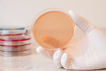 Salmonella Shigella agar. Laboratory doctor holding Salmonella Shigella agar petri dish