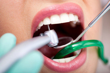 closeup of,dentist drilled teeth patient