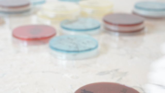 Laboratory doctor hands with sterile gloves using inoculation loop to isolate Staphylococcus bacteria from blood agar infected this bacteria. Medical laboratory concept