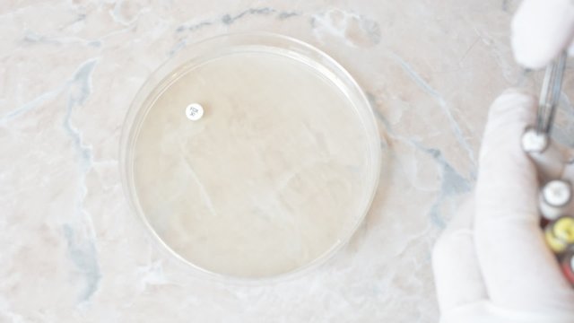 Laboratory doctor or scientific researcher doing an antibiogram on petri dish to test the efficacy of different antibiotics on bacteria