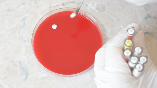 Laboratory doctor or scientific researcher doing an antibiogram on petri dish to test the efficacy of different antibiotics on bacteria